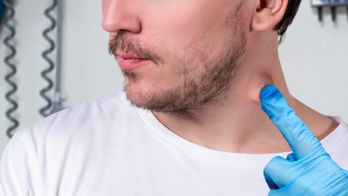Заключительная серия диагностических тестов определяет шишку на шее мужчины как ту, в которую весело тыкать